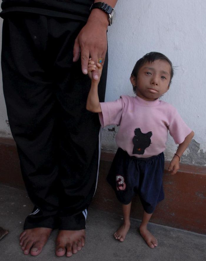smallest1